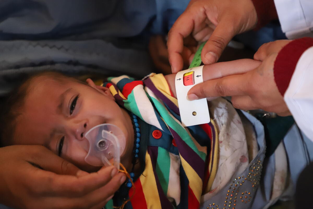 Afghanistan_A child found to be severely malnourished through WV's health and nutrition programme